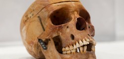 20 Herero and Nama Skulls – Namibia and Charité Universitätsmedizin Berlin, Germany